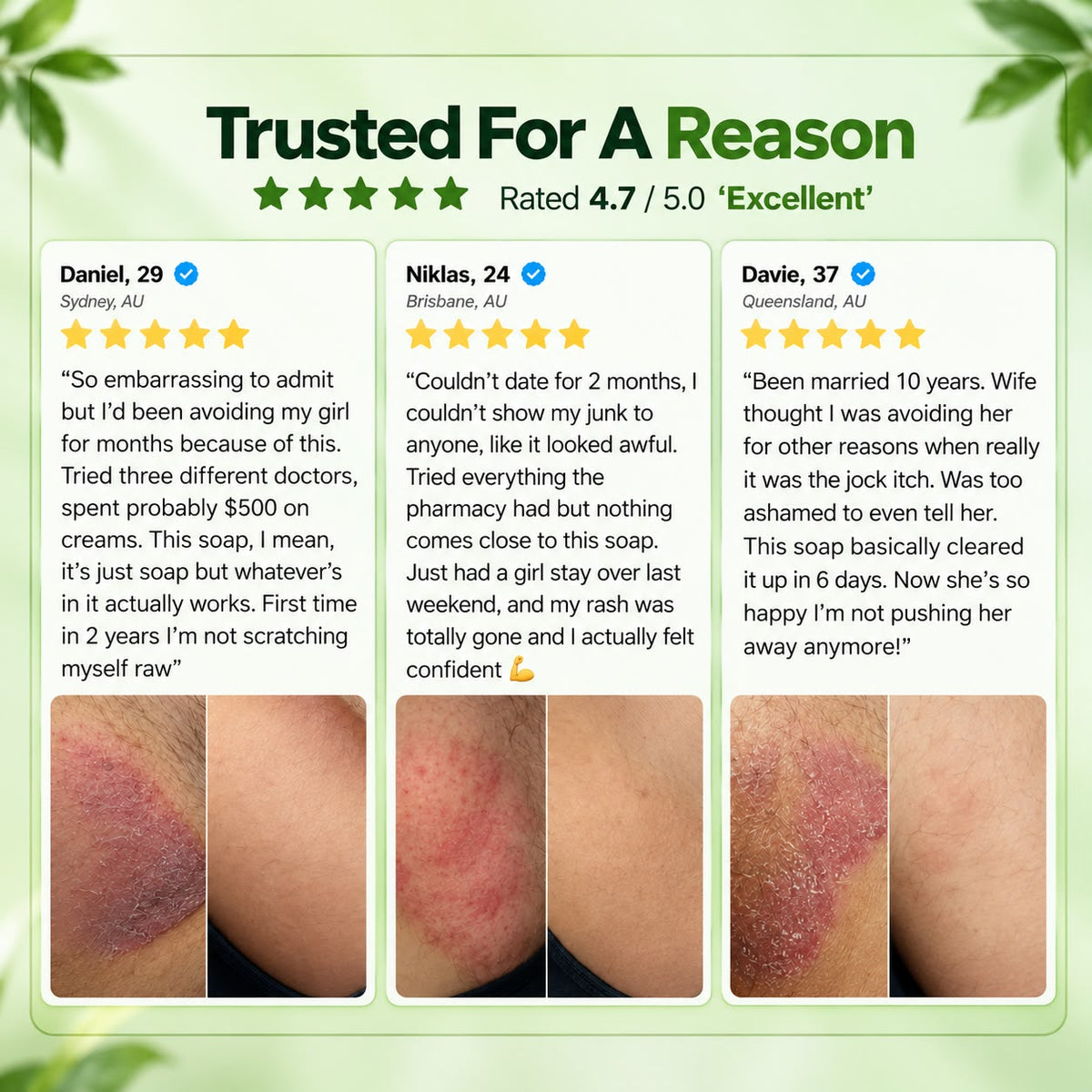 Royce Derm™ Antifungal Soap